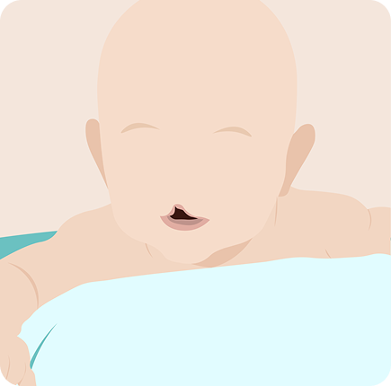  Cleft Lip and Palate Repair Image